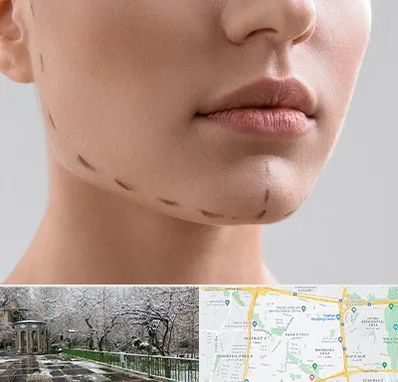 عمل زاویه فک در باغ فیض