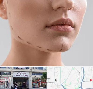 عمل زاویه فک در ایران زمین