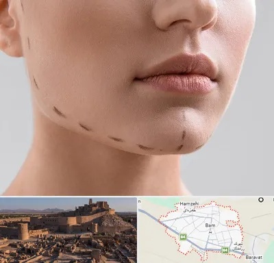 عمل زاویه فک در بم