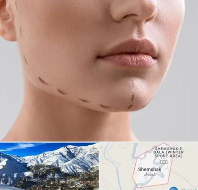 عمل زاویه فک در شمشک