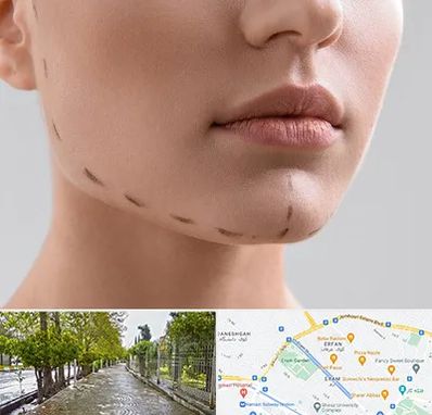 عمل زاویه فک در خیابان ارم شیراز