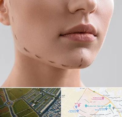 عمل زاویه فک در الهیه مشهد