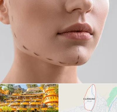 عمل زاویه فک در دربند