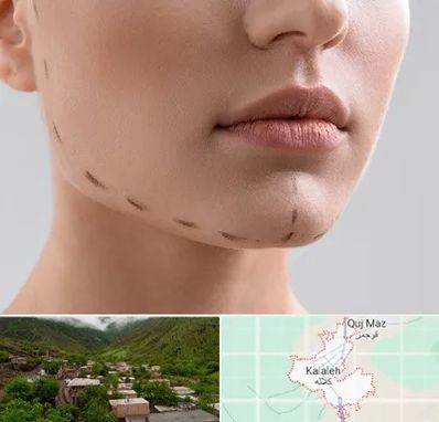عمل زاویه فک در کلاله