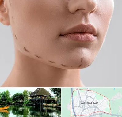 عمل زاویه فک در صومعه سرا