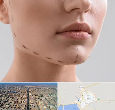 عمل زاویه فک در بندر ماهشهر