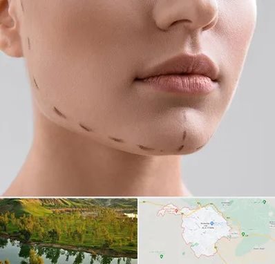 عمل زاویه فک در بهبهان