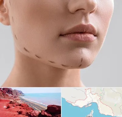 عمل زاویه فک در هرمزگان