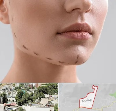 عمل زاویه فک در جماران