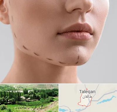 عمل زاویه فک در طالقان