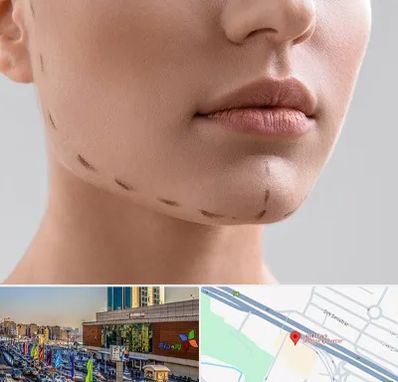 عمل زاویه فک در لاله پارک تبریز