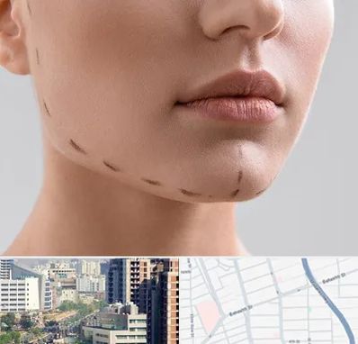 عمل زاویه فک در خیابان بهشتی