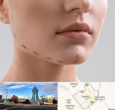 عمل زاویه فک در تایباد