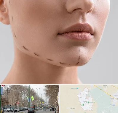 عمل زاویه فک در نظرآباد کرج