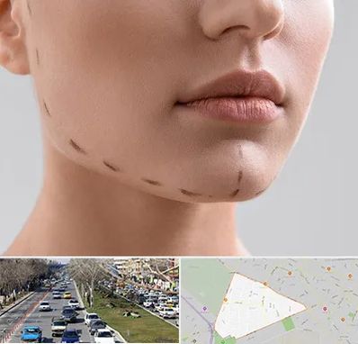 عمل زاویه فک در احمدآباد مشهد