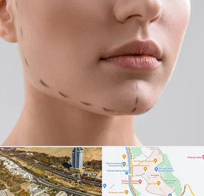 عمل زاویه فک در خیابان نیایش شیراز