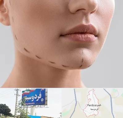 عمل زاویه فک در فردوسیه شهریار