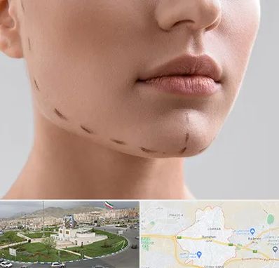 عمل زاویه فک در بومهن