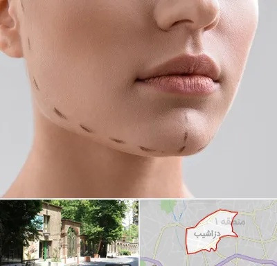 عمل زاویه فک در دزاشیب