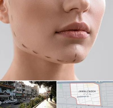 عمل زاویه فک در خیابان جمالزاده