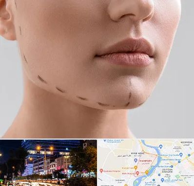 عمل زاویه فک در کیانپارس اهواز