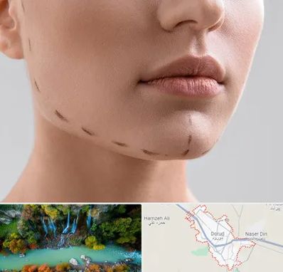 عمل زاویه فک در دورود