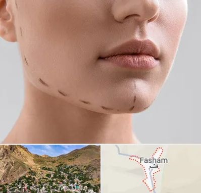 عمل زاویه فک در فشم