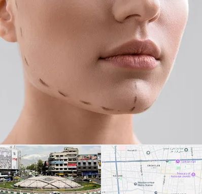 عمل زاویه فک در مرکز تهران