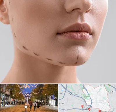 عمل زاویه فک در ولیعصر ارومیه