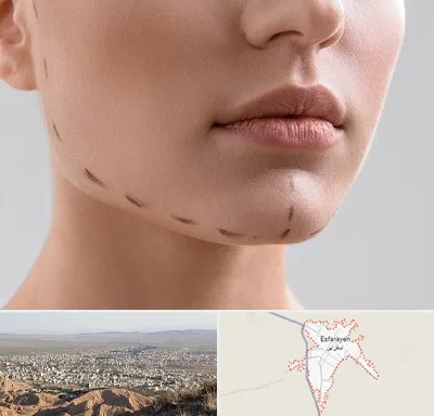 عمل زاویه فک در اسفراین
