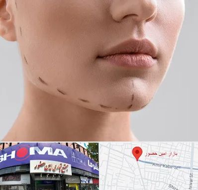 عمل زاویه فک در امین حضور