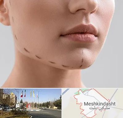 عمل زاویه فک در مشکین دشت