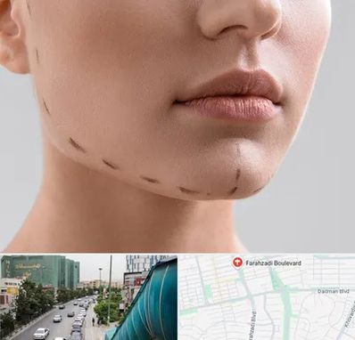 عمل زاویه فک در بلوار فرحزادی
