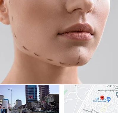 عمل زاویه فک در چهارراه طالقانی کرج