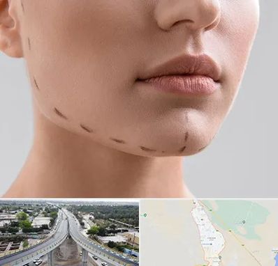 عمل زاویه فک در اندیمشک