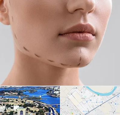 عمل زاویه فک در کوروش اهواز