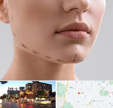 عمل زاویه فک در بلوار سجاد مشهد