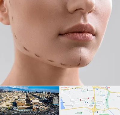 عمل زاویه فک در شهرک راه آهن