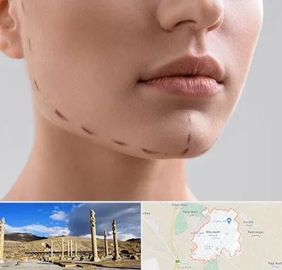 عمل زاویه فک در مرودشت