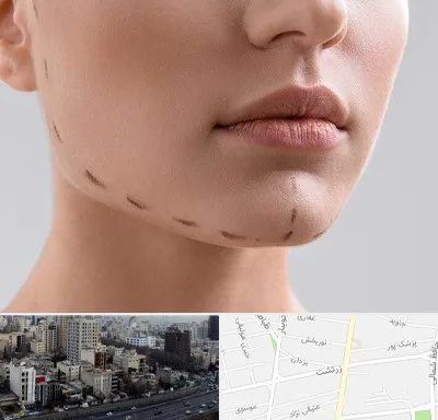 عمل زاویه فک در زرتشت