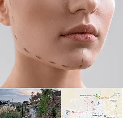 عمل زاویه فک در باغستان کرج