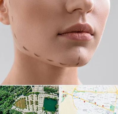 عمل زاویه فک در وکیل آباد مشهد