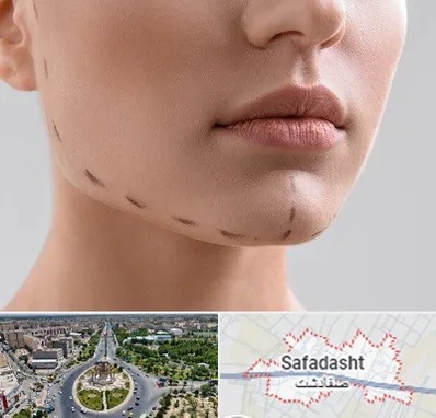 عمل زاویه فک در صفادشت