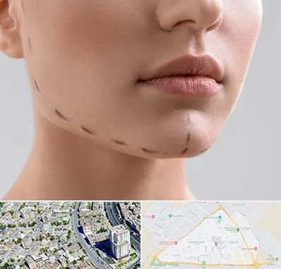 عمل زاویه فک در قاسم آباد مشهد