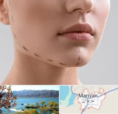 عمل زاویه فک در مریوان