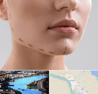 عمل زاویه فک در خرمشهر