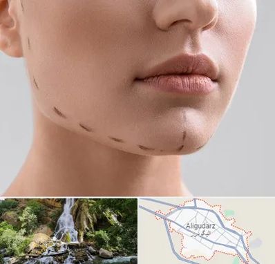 عمل زاویه فک در الیگودرز