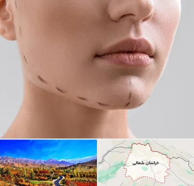 عمل زاویه فک در خراسان شمالی