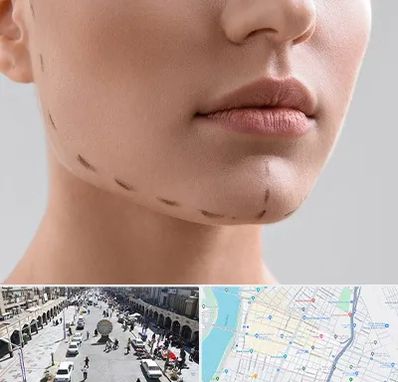 عمل زاویه فک در نادری اهواز