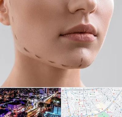 عمل زاویه فک در منظریه رشت